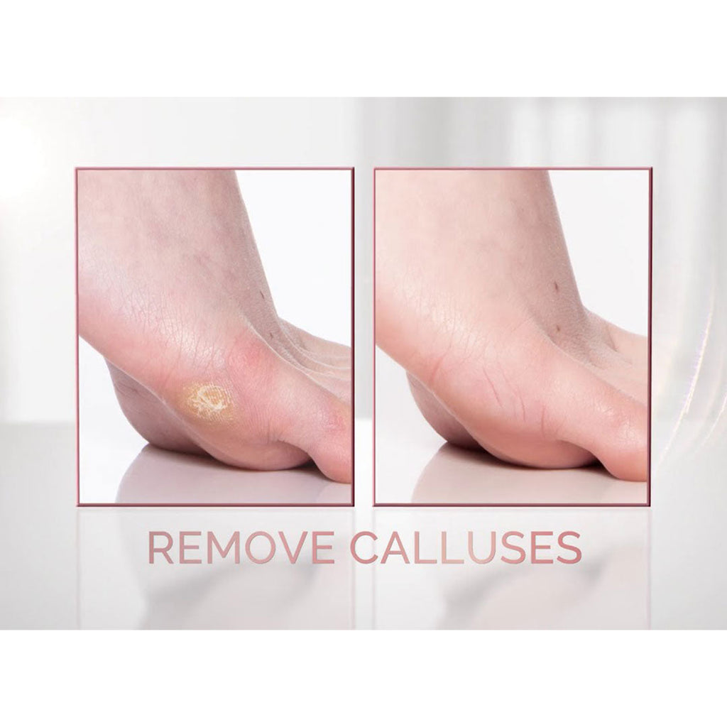 Electronic Pedi  Tool File and Callus Remover, Pedicure